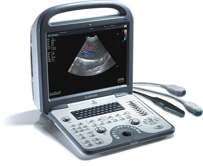 超音波画像診断機 ポータブルエコー